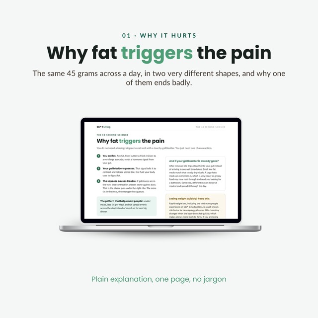 Gallbladder Diet Food List Printable | Gallstone Eat Limit Avoid Chart | Low Fat Meal Plan Grocery List and Food Guide After Removal PDF